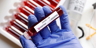 Количество вылеченных от коронавирусной инфекции в Алтайском крае за истекшие сутки  впервые превысило число зараженных